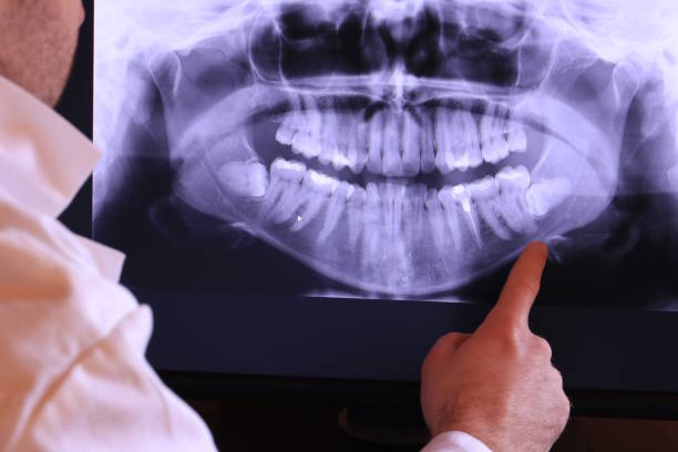 Best Tooth Infection Emergency Dentist  in Eldersburg, MD